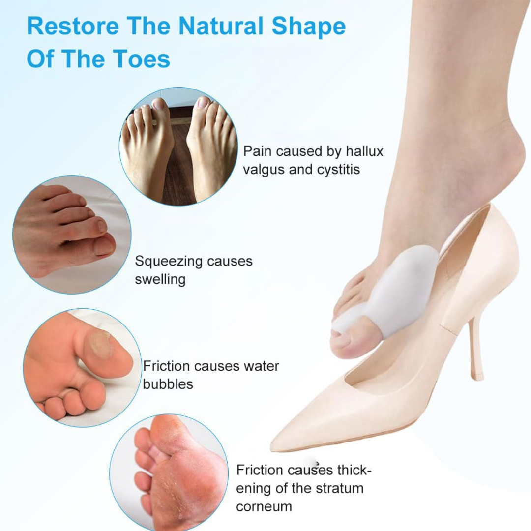 Pain-Free Bunion Corrector