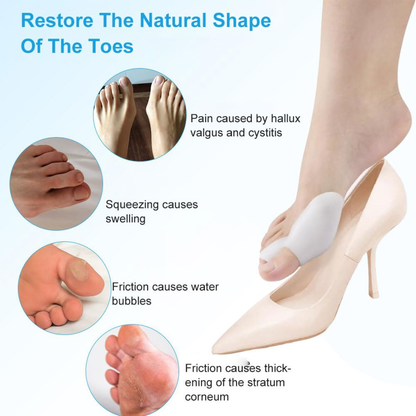 Pain-Free Bunion Corrector