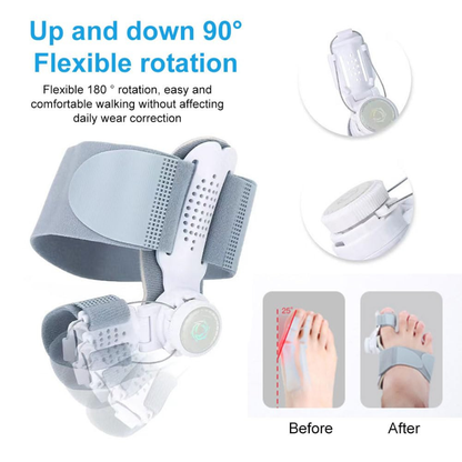 Pain-Free Bunion Corrector